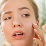 Unveiling the Power of Helix CO2 Laser: A New Era in Laser Resurfacing